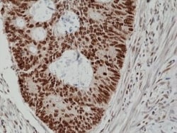 Invitrogen MSH2 Recombinant Rabbit Monoclonal Antibody (RM375) 100 &mu;L;