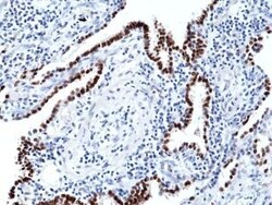 Invitrogen Nkx2.1 Recombinant Rabbit Monoclonal Antibody (RM373) 100 &mu;L;
