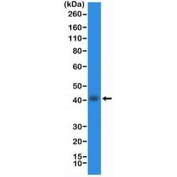 Invitrogen Nkx2.1 Recombinant Rabbit Monoclonal Antibody (RM373) 100 &mu;L;