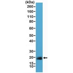 Invitrogen Caveolin 1 Recombinant Rabbit Monoclonal Antibody (RM325) 100