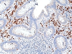 Invitrogen IRF4 Recombinant Rabbit Monoclonal Antibody (RM352) 100 &mu;L;