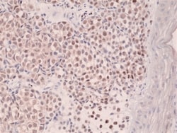 Invitrogen IRF4 Recombinant Rabbit Monoclonal Antibody (RM352) 100 &mu;L;