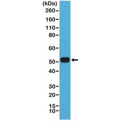 Invitrogen IRF4 Recombinant Rabbit Monoclonal Antibody (RM352) 100 &mu;L;