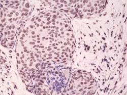Invitrogen Phospho-p38 MAPK beta (Thr180, Tyr182) Recombinant Rabbit Monoclonal
