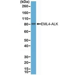 Invitrogen ALK Recombinant Rabbit Monoclonal Antibody (RM361) 100 &mu;L;