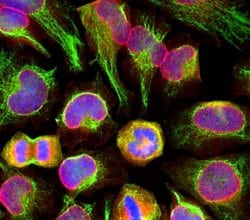Invitrogen Nuclear Pore Complex Monoclonal Antibody (39C7) 100 &mu;L; Unconjugated:Antibodies,
