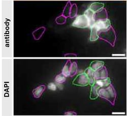 Invitrogen DJ-1 Monoclonal Antibody (4H4) 100 &mu;L | Buy Online | Invitrogen&trade; | Fisher Scientific