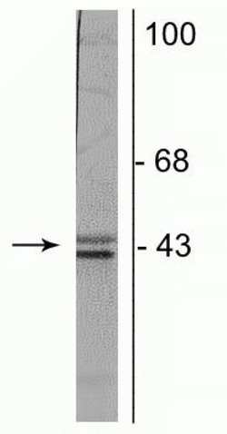 Invitrogen Doublecortin Monoclonal Antibody (3 e1) 100 &mu;L | Buy Online | Invitrogen&trade; | Fisher Scientific