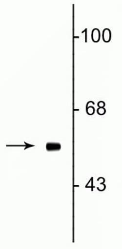 FTO Monoclonal Antibody (5-2H10):Antibodies, Monoclonal