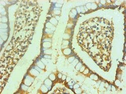 Invitrogen NSE Monoclonal Antibody (4B1F5) 100 &mu;g; Unconjugated:Antibodies,