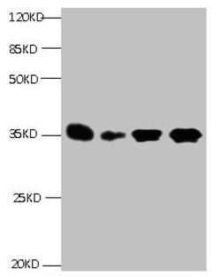Invitrogen IGFBP-1 Monoclonal Antibody (1E1B2) 100 &mu;g; Unconjugated:Antibodies,