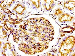 Invitrogen Actin Recombinant Rabbit Monoclonal Antibody (25E3) 100 &mu;L;