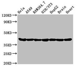 Invitrogen Actin Recombinant Rabbit Monoclonal Antibody (25E3) 100 &mu;L;