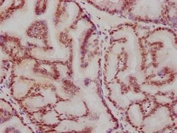 Invitrogen ATF2 Recombinant Rabbit Monoclonal Antibody (3D12) 100 &mu;L;