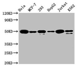 Invitrogen ATF4 Recombinant Rabbit Monoclonal Antibody (9E1) 100 &mu;L | Buy Online | Invitrogen&trade; | Fisher Scientific