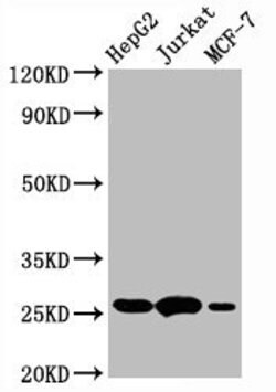 Invitrogen Bcl-2 Recombinant Rabbit Monoclonal Antibody (2C6) 100 &mu;L | Buy Online | Invitrogen&trade; | Fisher Scientific