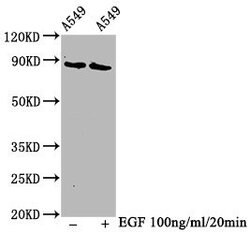 Invitrogen Phospho-B-Raf (Thr401) Recombinant Rabbit Monoclonal Antibody