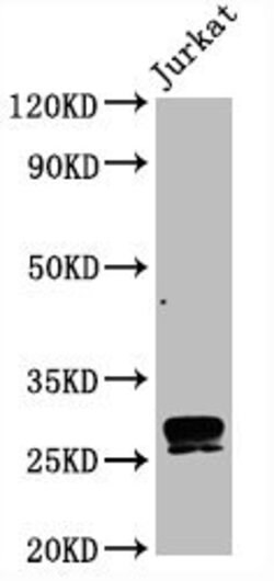 Invitrogen CD99 Recombinant Rabbit Monoclonal Antibody (9A5) 100 &mu;L | Buy Online | Invitrogen&trade; | Fisher Scientific