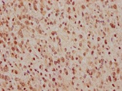 Invitrogen Cdc25C Recombinant Rabbit Monoclonal Antibody (3E6) 100 &mu;L;