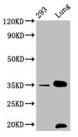 Invitrogen Calponin 1 Recombinant Rabbit Monoclonal Antibody (2H1) 100