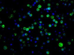 Invitrogen CD21 Recombinant Rabbit Monoclonal Antibody (16F10) 100 &mu;L;