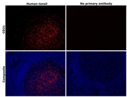 Invitrogen CD21 Recombinant Rabbit Monoclonal Antibody (16F10) 100 &mu;L;