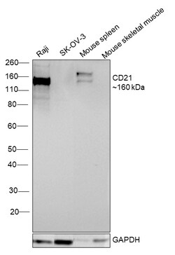 Invitrogen CD21 Recombinant Rabbit Monoclonal Antibody (16F10) 100 &mu;L;