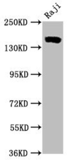 Invitrogen CD21 Recombinant Rabbit Monoclonal Antibody (16F10) 100 &mu;L;