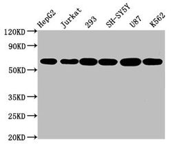 Invitrogen Aromatase Recombinant Rabbit Monoclonal Antibody (1H1) 100 &mu;L;
