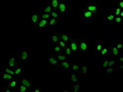 Invitrogen FEN1 Recombinant Rabbit Monoclonal Antibody (4D9) 100 &mu;L;