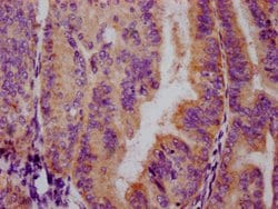 Invitrogen Phospho-FOXO3A (Ser253) Recombinant Rabbit Monoclonal Antibody