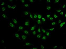 Invitrogen Phospho-mTOR (Ser2481) Recombinant Rabbit Monoclonal Antibody