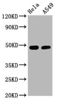 Invitrogen Phospho-GATA3 (Ser308) Recombinant Rabbit Monoclonal Antibody