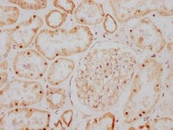 Invitrogen GDNF Recombinant Rabbit Monoclonal Antibody (11D2) 100 &mu;L;