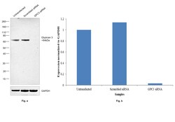 Invitrogen Glypican 3 Recombinant Rabbit Monoclonal Antibody (4H11) 100