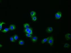 Invitrogen Glypican 3 Recombinant Rabbit Monoclonal Antibody (4H11) 100