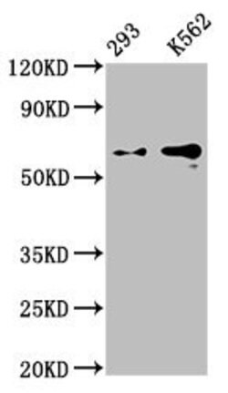 Invitrogen Glypican 3 Recombinant Rabbit Monoclonal Antibody (4H11) 100