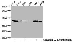 Invitrogen Phospho-GSK3B (Ser9) Recombinant Rabbit Monoclonal Antibody