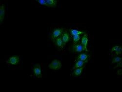 Invitrogen Phospho-GYS1 (Ser641) Recombinant Rabbit Monoclonal Antibody