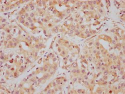 Invitrogen HDAC6 Recombinant Rabbit Monoclonal Antibody (2H12) 100 &mu;L;