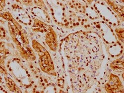 Invitrogen HDAC9 Recombinant Rabbit Monoclonal Antibody (1F2) 100 &mu;L | Buy Online | Invitrogen&trade; | Fisher Scientific
