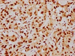 Invitrogen HDAC9 Recombinant Rabbit Monoclonal Antibody (1F2) 100 &mu;L | Buy Online | Invitrogen&trade; | Fisher Scientific