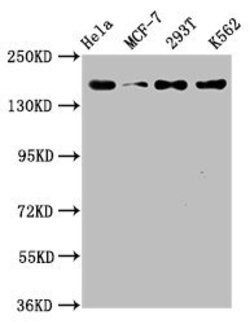 Invitrogen HDAC9 Recombinant Rabbit Monoclonal Antibody (1F2) 100 &mu;L | Buy Online | Invitrogen&trade; | Fisher Scientific