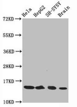 Invitrogen H3K14ac Recombinant Rabbit Monoclonal Antibody (3H3) 100 &mu;L;