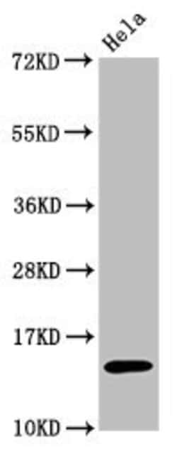 Invitrogen H3K56ac Recombinant Rabbit Monoclonal Antibody (3H2) 100 &mu;L;