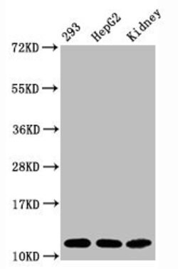 Invitrogen H4K16ac Recombinant Rabbit Monoclonal Antibody (2B8) 100 &mu;L;