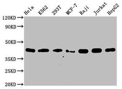 Invitrogen hnRNP C Recombinant Rabbit Monoclonal Antibody (9G1) 100 &mu;L;