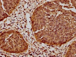 Invitrogen HSP27 Recombinant Rabbit Monoclonal Antibody (10C11) 100 &mu;L;