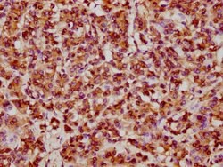 Invitrogen HSP27 Recombinant Rabbit Monoclonal Antibody (10C11) 100 &mu;L;