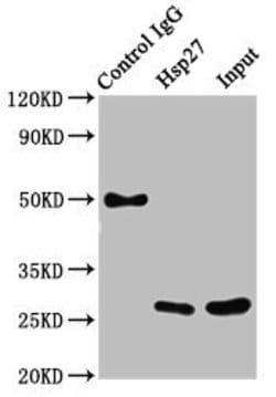 Invitrogen HSP27 Recombinant Rabbit Monoclonal Antibody (10C11) 100 &mu;L;